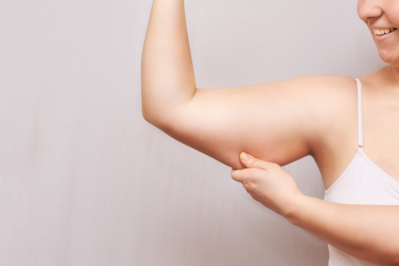 Women showing her excess skim and fat around her arm. Considering plastic surgery arm reduction, brachioplasty.